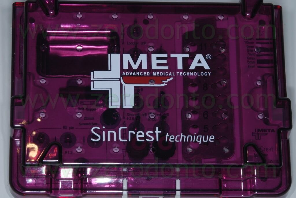 Sincrest Meta