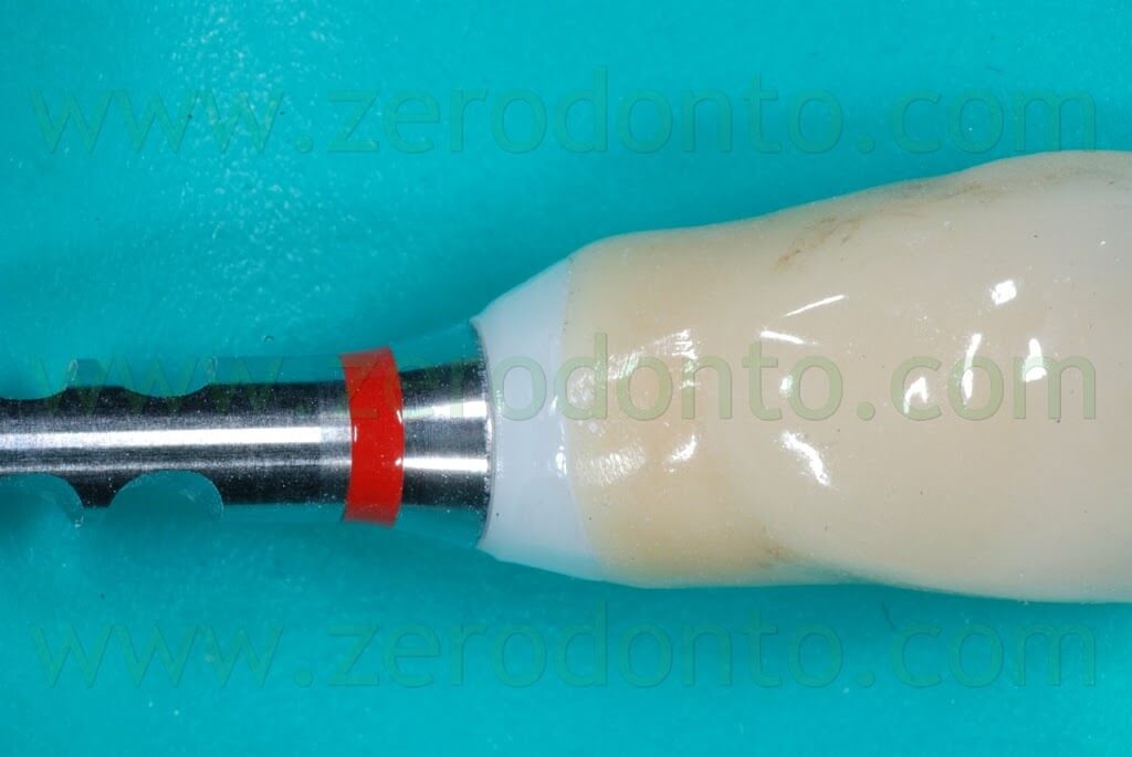 zirconia implant analog