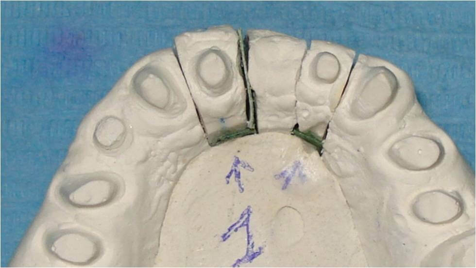 ortodonzia provvisorio guidata
