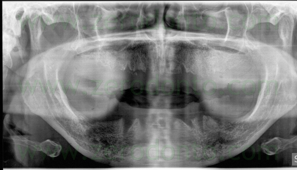 - (7) ortopantomografia