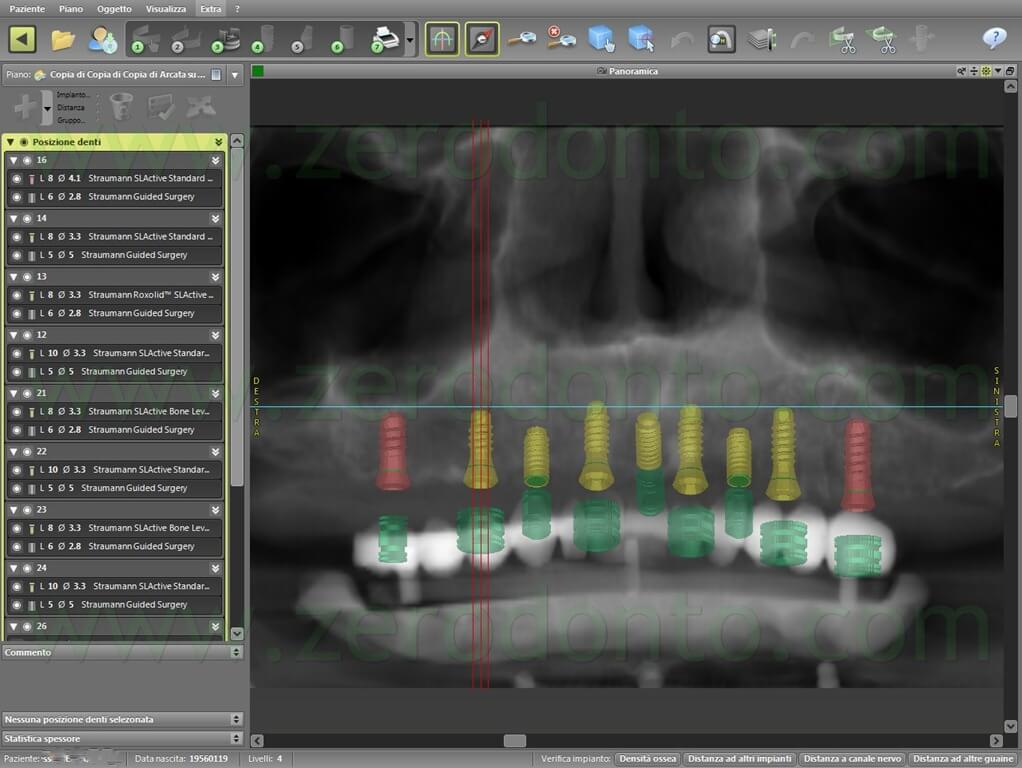 Straumann Roxolid Slactive Implant