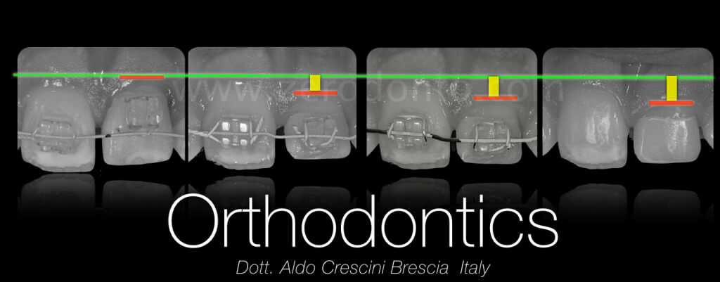 CERUTTI zerodonto 2014 finale.010