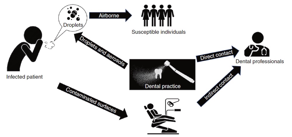 covid-19-transmission-dentistry