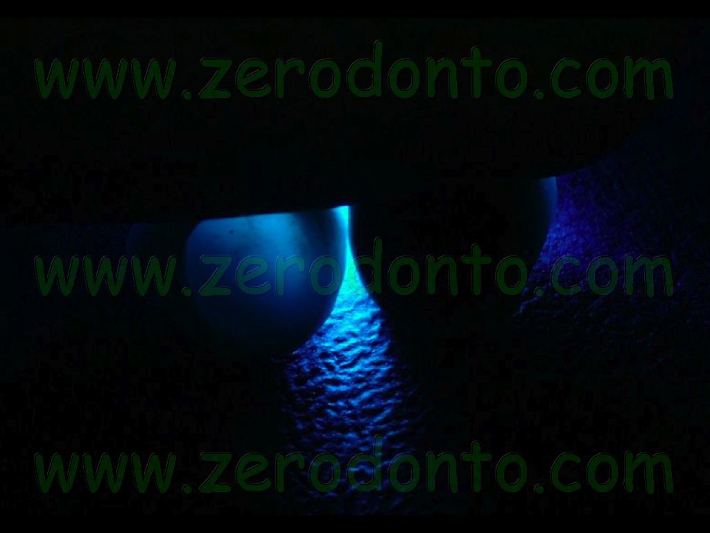 Transilluminazione corona zirconia vs metallo-ceramica