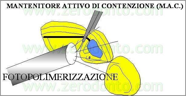 terapia ortodontica del prof. Aldo Macchi