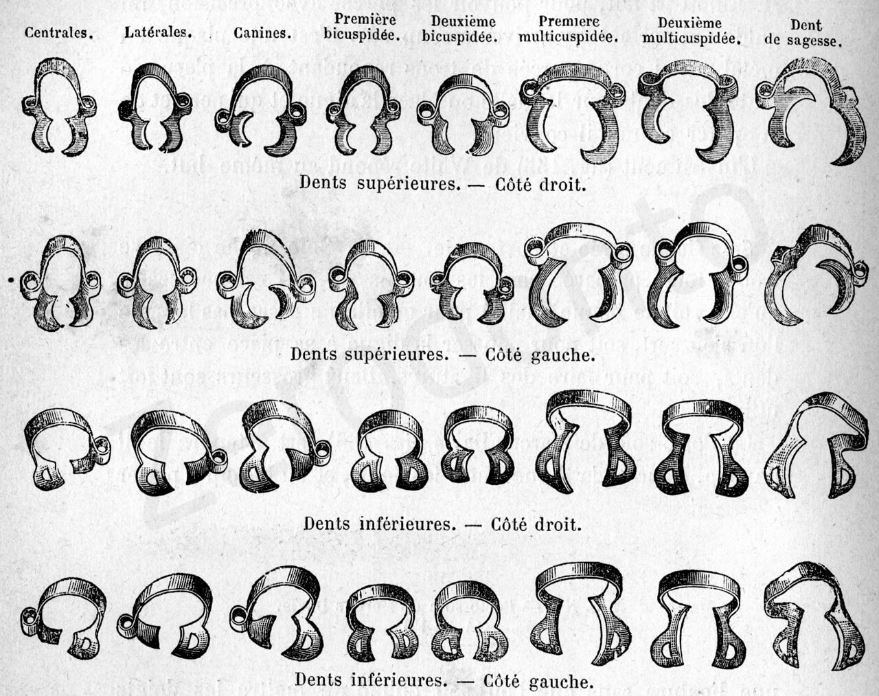 Fig. 3. A. Il set di uncini metallici introdotti dal Dr. Delous Palmer in 1882. 
